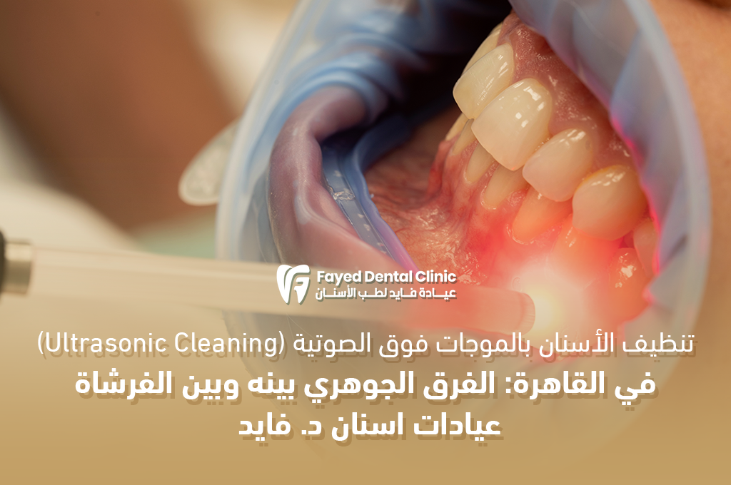التنظيف بالموجات الصوتية في القاهرة: الفرق الجوهري بين Ultrasonic Scaling وتنظيف الأسنان بالفرشاة – د. فايد