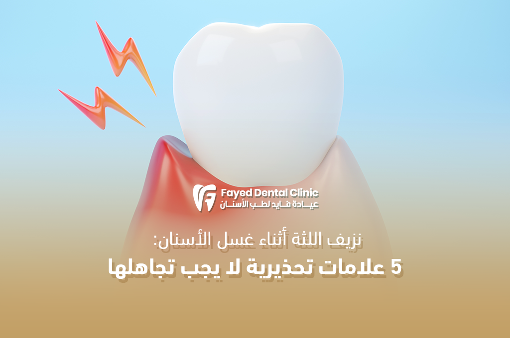 حلول نزيف اللثة عند غسل الأسنان من عيادة د. فايد في القاهرة