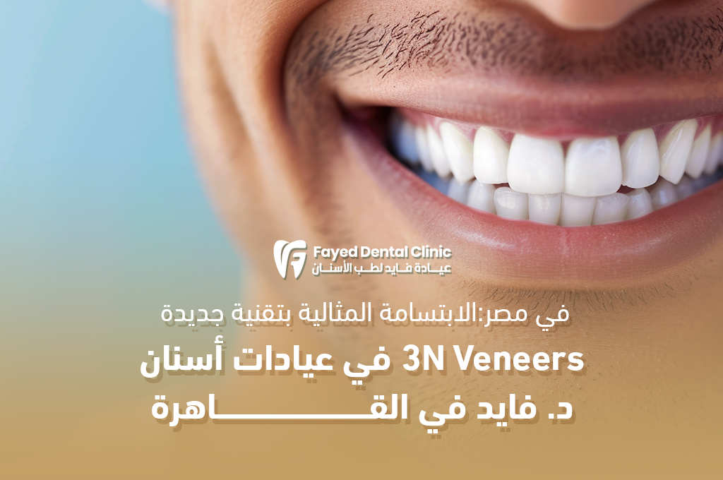 3N Veneers في مصر: الابتسامة المثالية بتقنية جديدة – عيادة د. فايد أسنان بالقاهرة